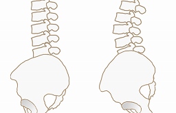慢性的な腰痛と骨盤の関係