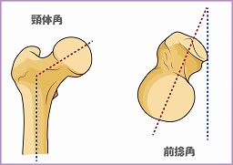 胡坐が出来ない股関節が痛い