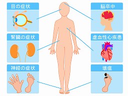 糖尿病での運動療法について