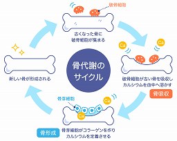 骨折しやすくなる骨粗しょう症