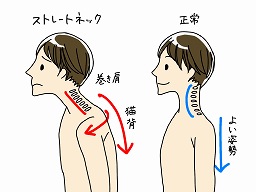 【知ってた？頭は重いって】首が回らなくなった本当の原因