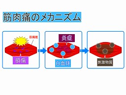 農作業で筋肉痛になったら