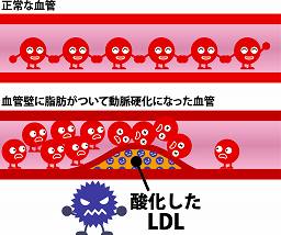 LDLコレステロールを下げるには