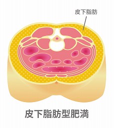 皮下脂肪を確実に落とすには